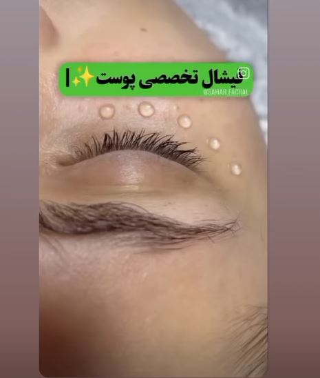 فیشیال تخصصی پوست