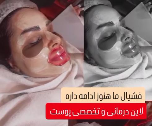 لاین درمانی و تخصصی پوست با ماسک